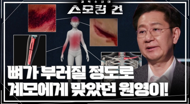 유난히 작고 말랐던 아이, 원영이의 부검 결과!